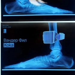 Вандер Фил - Кока